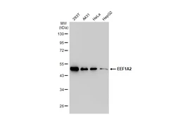 Anti-EEF1A2 antibody [C1C3] used in Western Blot (WB). GTX102327