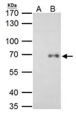 Anti-RelB antibody used in Immunoprecipitation (IP). GTX102333