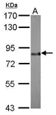 Anti-BAG3 antibody [N1C1] used in Western Blot (WB). GTX102343