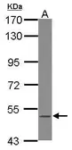 Anti-BLK antibody [N3C2], Internal used in Western Blot (WB). GTX102348