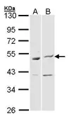 Anti-BAG5 antibody [N1N3] used in Western Blot (WB). GTX102356