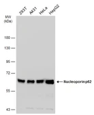 Anti-Nucleoporin p62 antibody used in Western Blot (WB). GTX102359