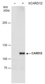 Anti-CARD12 antibody [N1], N-term used in Western Blot (WB). GTX102366