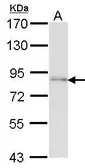 Anti-FAF1 antibody used in Western Blot (WB). GTX102369