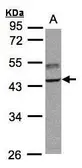Anti-TRAF1 antibody [N1C1] used in Western Blot (WB). GTX102372