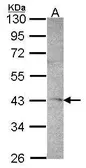 Anti-DRAK1 antibody [C1C3] used in Western Blot (WB). GTX102375