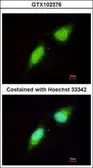 Anti-NADE antibody [N1C3] used in Immunocytochemistry/ Immunofluorescence (ICC/IF). GTX102376