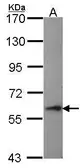 Anti-Perforin antibody [N1N3] used in Western Blot (WB). GTX102379