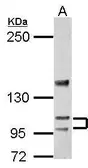 Anti-SERCA3 antibody [N1N2], N-term used in Western Blot (WB). GTX102381