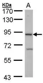 Anti-Cbl-b antibody [C2C3], C-term used in Western Blot (WB). GTX102389