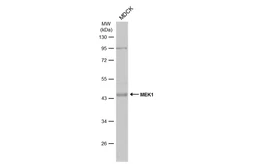 Anti-MEK1 antibody used in Western Blot (WB). GTX102391