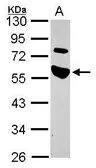 Anti-TRIP antibody [N3C2], Internal used in Western Blot (WB). GTX102402