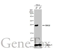 Anti-BAG2 antibody used in Western Blot (WB). GTX102406
