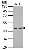 Anti-PDCD2 antibody [N1C1] used in Western Blot (WB). GTX102409