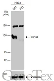 Anti-CD146 antibody [N1N3] used in Western Blot (WB). GTX102413