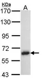 Anti-TRAF5 antibody [N1N3] used in Western Blot (WB). GTX102415
