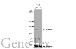 Anti-BMPR2 antibody [C1C3] used in Western Blot (WB). GTX102418