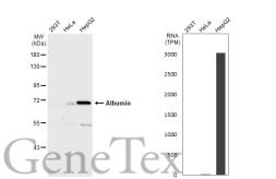 Anti-Albumin antibody used in Western Blot (WB). GTX102419