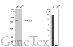 Anti-COL4A2 antibody [N2N3] used in Western Blot (WB). GTX102422