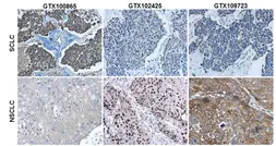 Anti-p63 antibody [N2C1], Internal used in IHC (Paraffin sections) (IHC-P). GTX102425