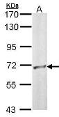 Anti-RBBP5 antibody [N1N3] used in Western Blot (WB). GTX102440