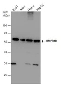 Anti-BMPR1B antibody [N3C3] used in Western Blot (WB). GTX102453