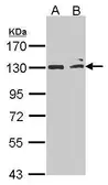 Anti-MAP3K14 antibody [N1N2], N-term used in Western Blot (WB). GTX102471