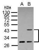 Anti-ING1 antibody [C1C3] used in Western Blot (WB). GTX102478
