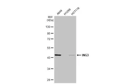 Anti-ING3 antibody [N2N3] used in Western Blot (WB). GTX102480