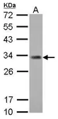 Anti-ING5 antibody [N2C1], Internal used in Western Blot (WB). GTX102482