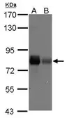 Anti-Caldesmon antibody [N1N2], N-term used in Western Blot (WB). GTX102498