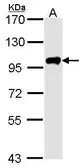 Anti-Calpain 3 antibody [C2C3], C-term used in Western Blot (WB). GTX102500