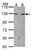 Anti-K-Cadherin antibody [N2C1], Internal used in Western Blot (WB). GTX102502