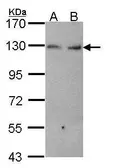 Anti-K-Cadherin antibody [N2C1], Internal used in Western Blot (WB). GTX102502