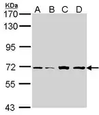 Anti-IRAK2 antibody [N2C1], Internal used in Western Blot (WB). GTX102518