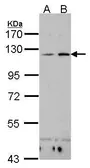 Anti-CD11c antibody used in Western Blot (WB). GTX102519