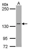 Anti-RPB2 antibody [N1], N-term used in Western Blot (WB). GTX102535