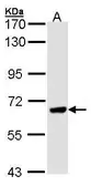Anti-PPEF1 antibody [N1N2], N-term used in Western Blot (WB). GTX102537