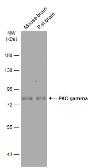 Anti-PKC gamma antibody used in Western Blot (WB). GTX102539