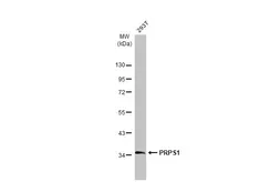 Anti-PRPS1 antibody used in Western Blot (WB). GTX102570