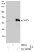 Anti-GABPA antibody [N2C2], Internal used in Immunoprecipitation (IP). GTX102572
