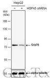 Anti-Grp78 antibody [N2C1], Internal used in Western Blot (WB). GTX102580