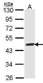 Anti-Fumarylacetoacetate hydrolase antibody [N1C1] used in Western Blot (WB). GTX102583