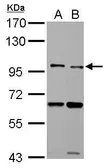 Anti-TLR5 antibody used in Western Blot (WB). GTX102590