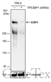 Anti-53BP1 antibody [N1], N-term used in Western Blot (WB). GTX102595