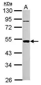 Anti-PIGA antibody used in Western Blot (WB). GTX102597