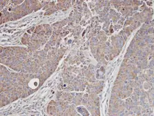 Anti-MRCK alpha antibody used in IHC (Paraffin sections) (IHC-P). GTX102598