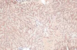 Anti-BSEP antibody [N3C1], Internal used in IHC (Paraffin sections) (IHC-P). GTX102608