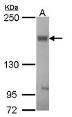 Anti-BSEP antibody [N3C1], Internal used in Western Blot (WB). GTX102608