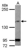 Anti-MAGI1 antibody [C2], C-term used in Western Blot (WB). GTX102612
